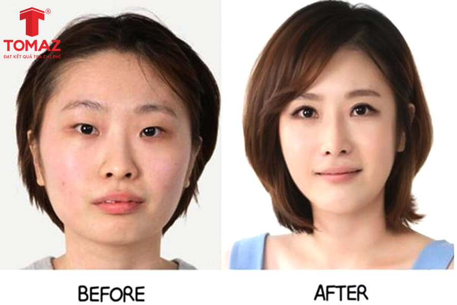 sử dụng hình ảnh trước và sau để quảng cáo
